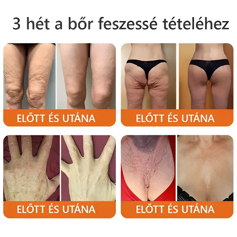 ✨ ZödVita® Méhméreg Bőr Helyreállító Krém 🔥 Magyar fejlesztés, magyarországi gyártás és szállítás
