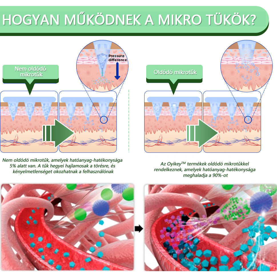 🍏Voilaist® SMGT-GLP-1 Nano Mikrotűs Tapasz (Fájdalommentes, hosszan tartó, kezeli a cukorbetegséget, az elhízást és a szív- és érrendszeri betegségeket)