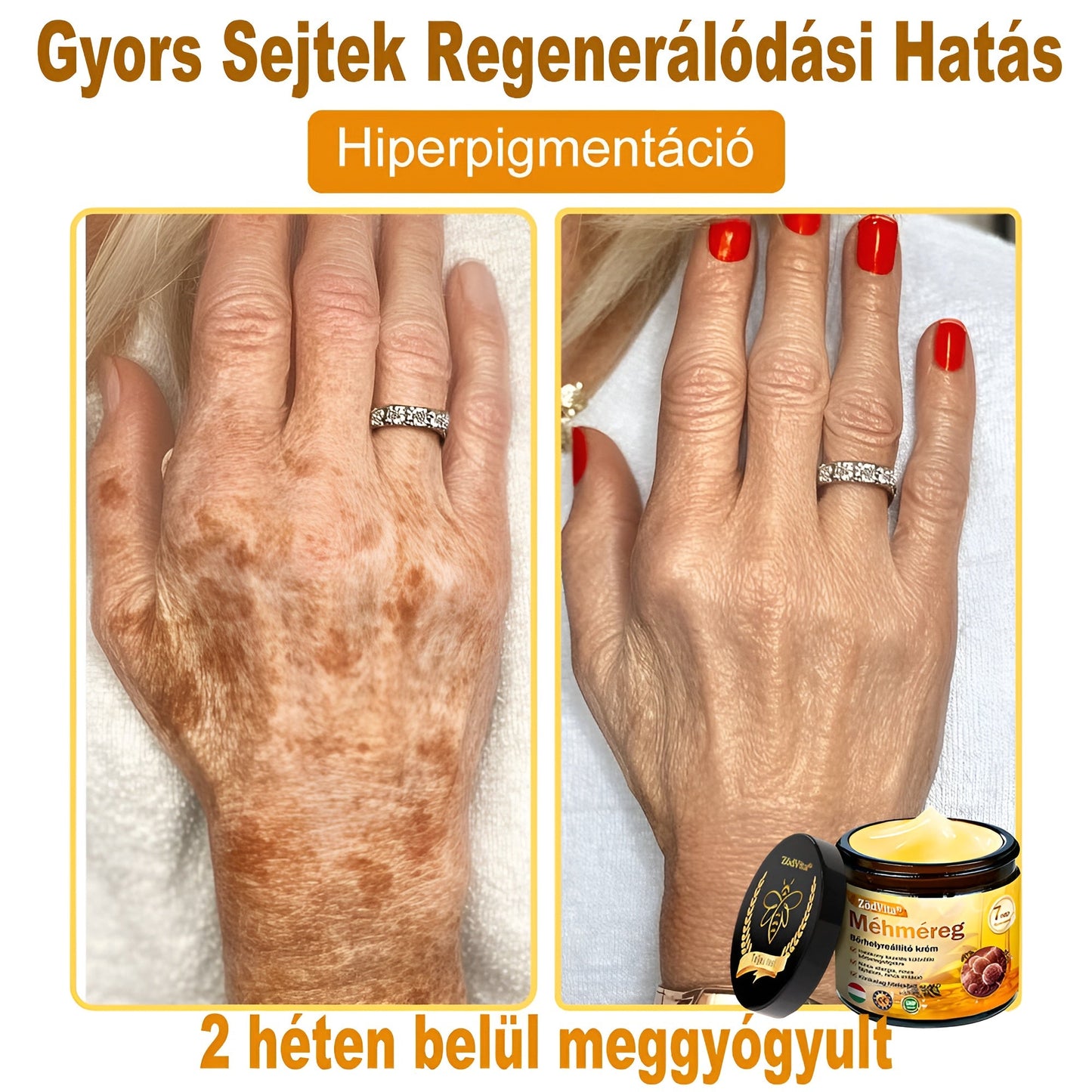 ✨ ZödVita® Méhméreg Bőr Helyreállító Krém 🔥 Magyar fejlesztés, magyarországi gyártás és szállítás