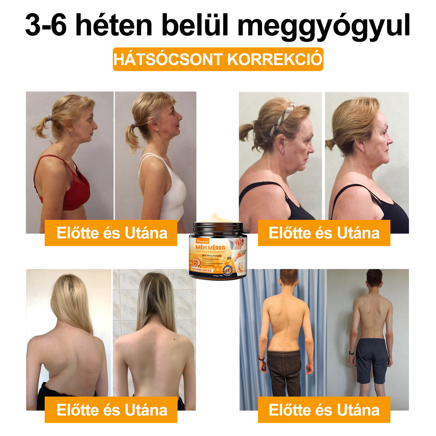 đđđđłđźÌđ„đđđąđđąđđđ„âą MĂ©h MĂ©reg ĂzĂŒleti RegenerĂĄlĂł KrĂ©m - CE minĆsĂtĂ©st szerzett - Minden korosztĂĄly szĂĄmĂĄra alkalmas