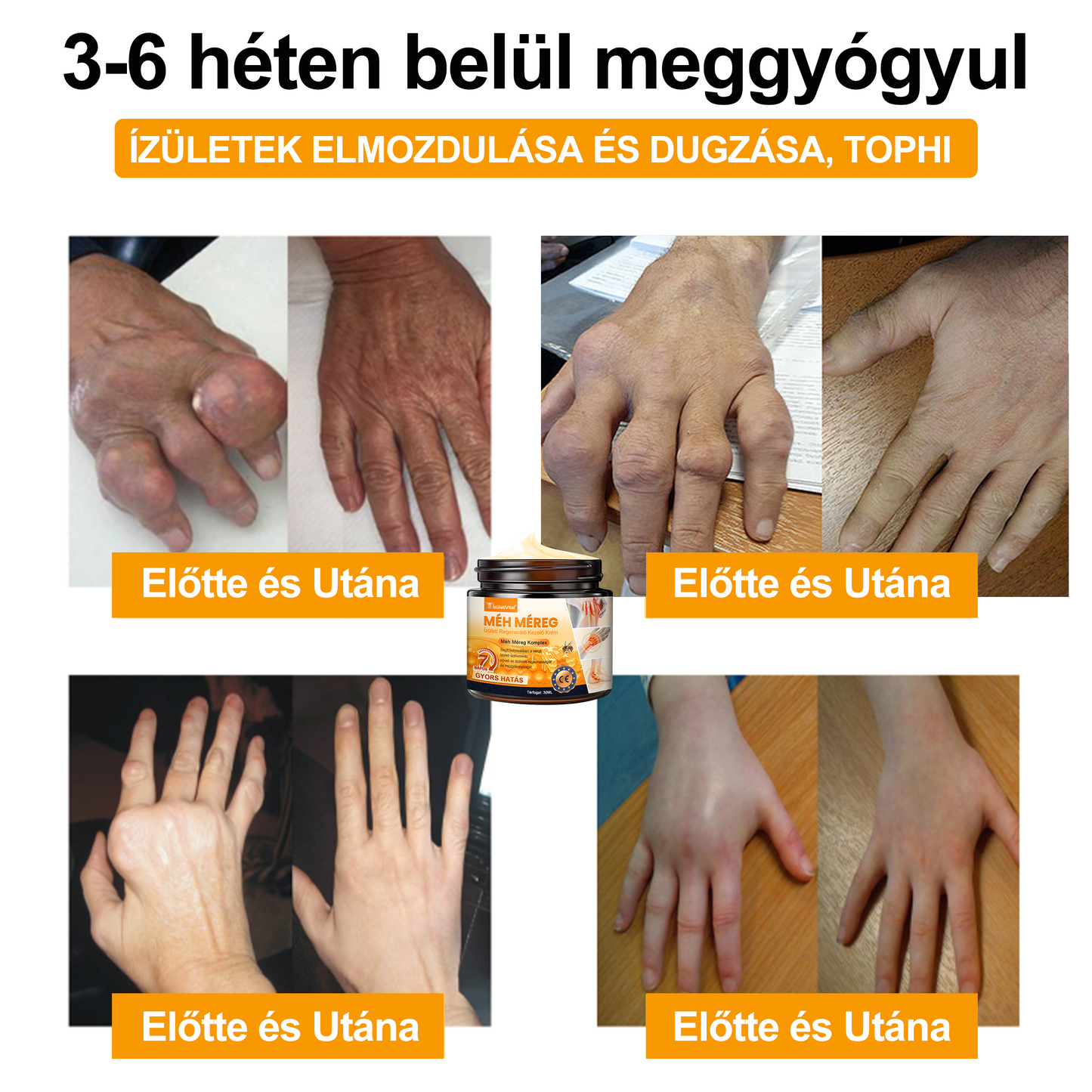 đđđđłđźÌđ„đđđąđđąđđđ„âą MĂ©h MĂ©reg ĂzĂŒleti RegenerĂĄlĂł KrĂ©m - CE minĆsĂtĂ©st szerzett - Minden korosztĂĄly szĂĄmĂĄra alkalmas