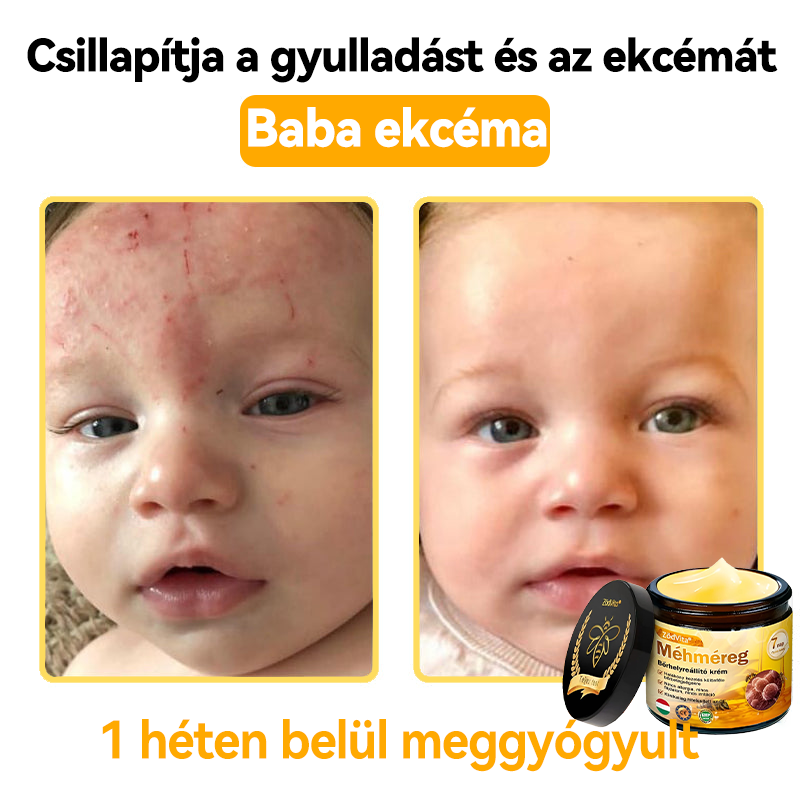 🌟 ZödVita® Méhméreg Bőrhelyreállító Krém 🧑⚕️Bőrgyógyász ajánlása ✅ CE jóváhagyott - 50ml