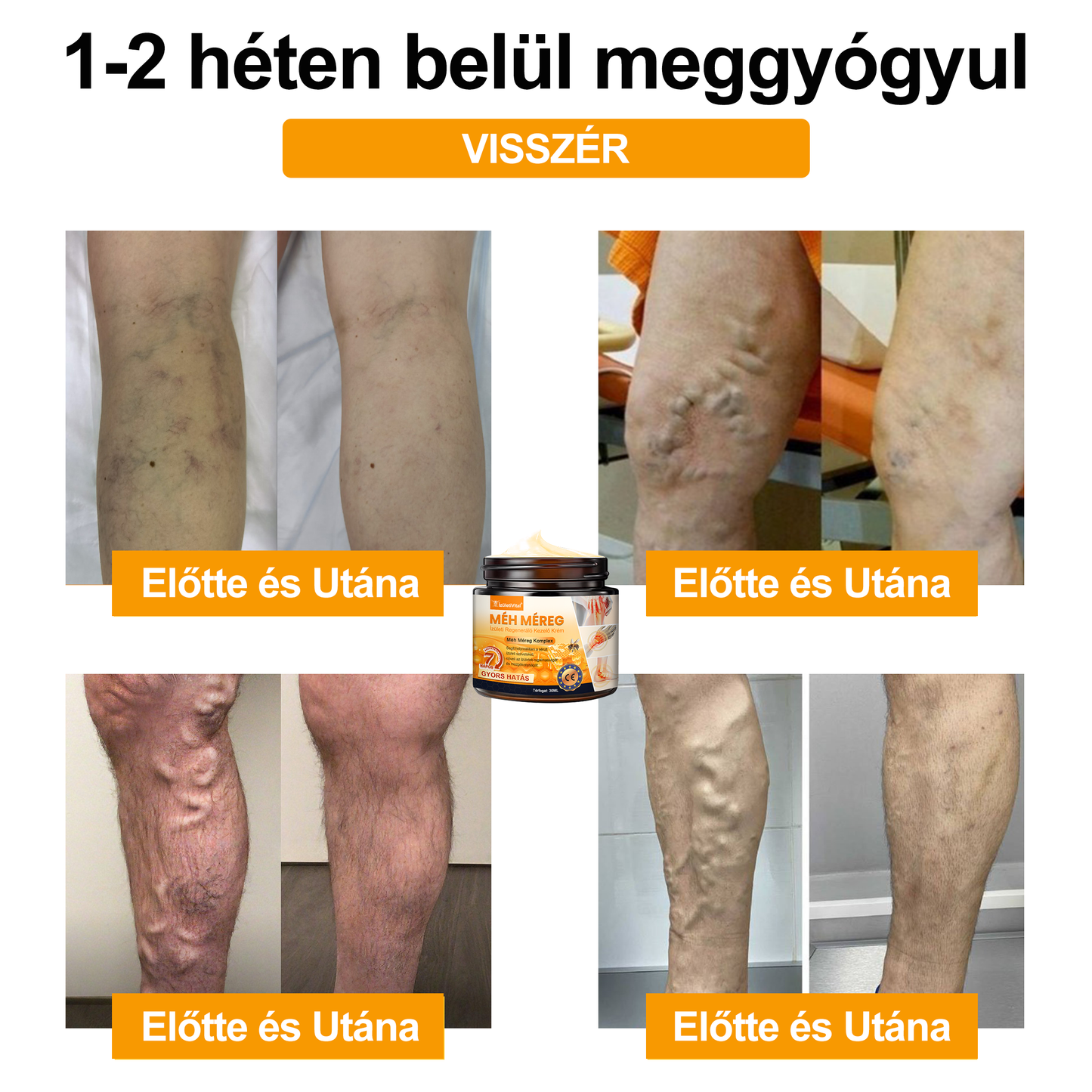 đđđđłđźÌđ„đđđąđđąđđđ„âą MĂ©h MĂ©reg ĂzĂŒleti RegenerĂĄlĂł KrĂ©m - CE minĆsĂtĂ©st szerzett - Minden korosztĂĄly szĂĄmĂĄra alkalmas