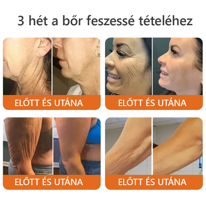 ZödVita® Méhméreg Bőr Helyreállító Krém 🔥Természetes Öregedésgátló, Feszesíti a Bőrt, Csökkenti a Ráncokat– 50ml