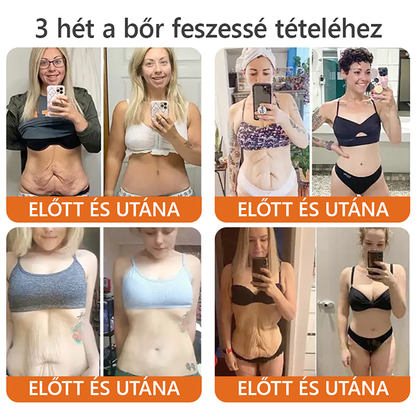 ZödVita® Méhméreg Bőr Helyreállító Krém 🔥Természetes Öregedésgátló, Feszesíti a Bőrt, Csökkenti a Ráncokat– 50ml