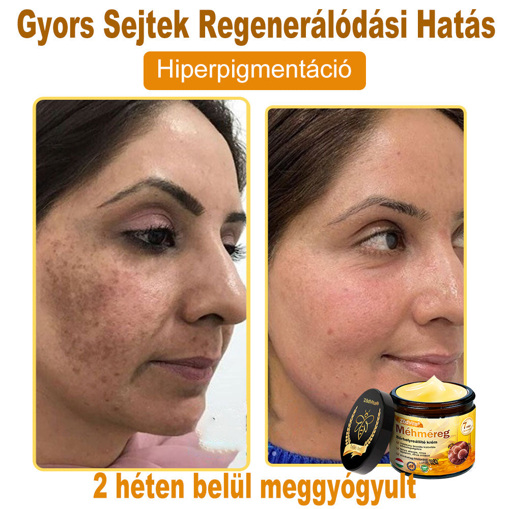 🌟 ZödVita® Méhméreg Bőr Helyreállító Krém 🔥Természetes Öregedésgátló, Feszesíti a Bőrt, Csökkenti a Ráncokat– 50ml