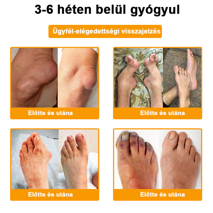 🟠𝑺𝒕𝒂𝒘𝑽𝒊𝒕𝒂𝒍® Botoxot és Méhmérget Tartalmazó Regeneráló Krém Ízületekre és Csontokra | MOT (Magyar Ortopéd Társaság) által tanúsított termék