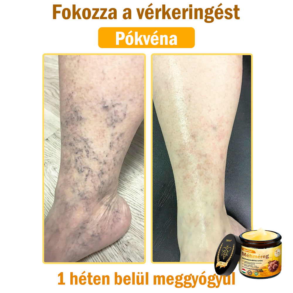 🌟 ZödVita® Méhméreg Bőrhelyreállító Krém 🧑‍⚕️Bőrgyógyász ajánlása ✅ CE jóváhagyott - 50ml