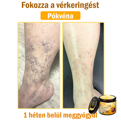 🌟 ZödVita® Méhméreg Bőrhelyreállító Krém 🧑‍⚕️Bőrgyógyász ajánlása ✅ CE jóváhagyott - 50ml