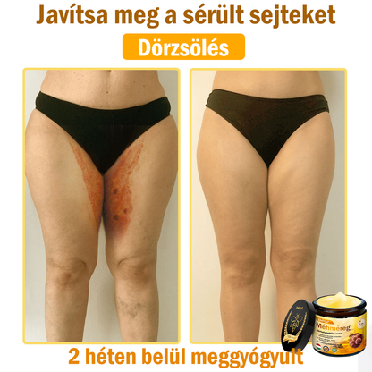🌟 ZödVita® Méhméreg Bőrhelyreállító Krém 🧑‍⚕️Bőrgyógyász ajánlása ✅ CE jóváhagyott - 50ml