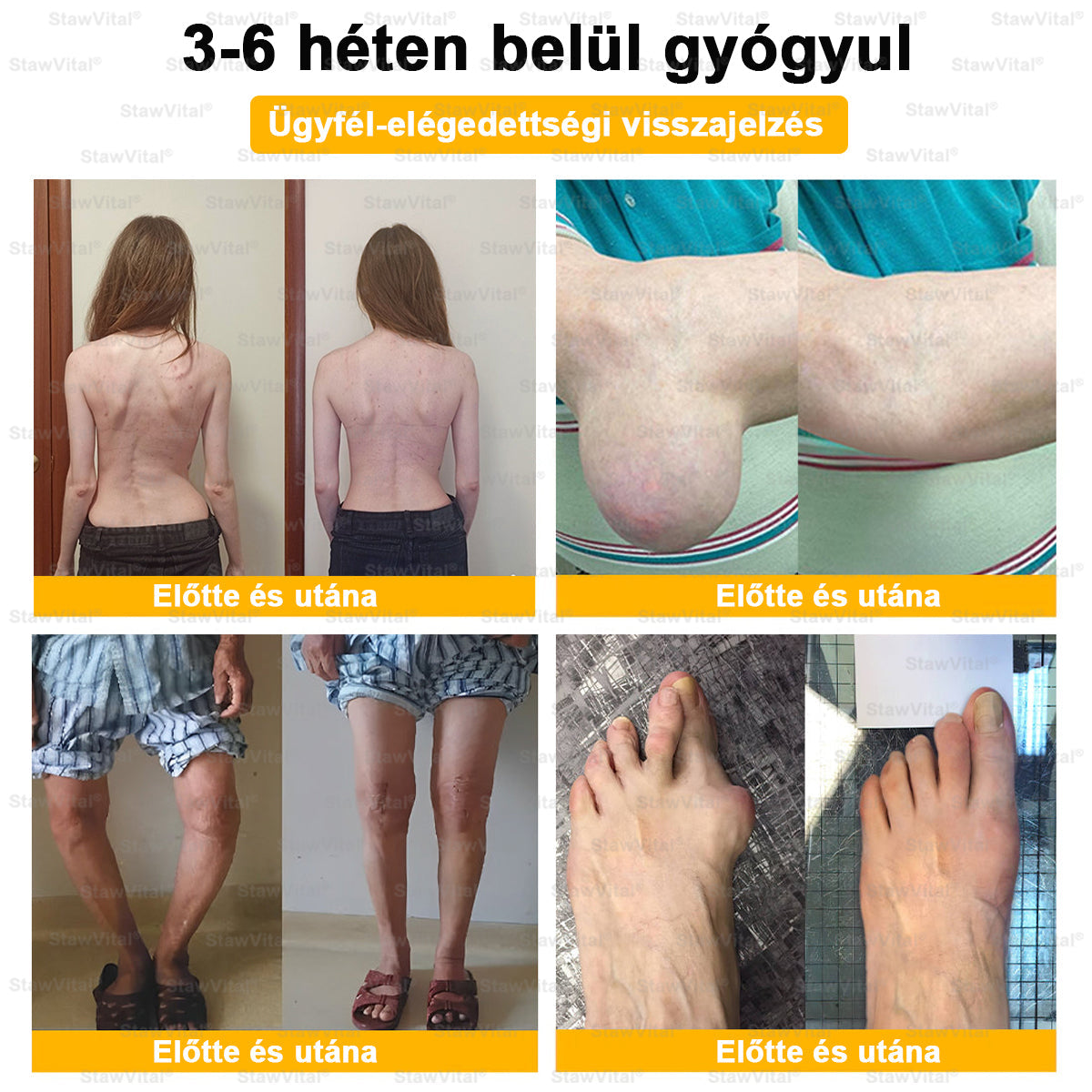 🟠𝑺𝒕𝒂𝒘𝑽𝒊𝒕𝒂𝒍® Botoxot és Méhmérget Tartalmazó Regeneráló Krém Ízületekre és Csontokra | MOT (Magyar Ortopéd Társaság) által tanúsított termék