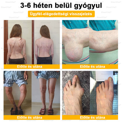 🟠𝑺𝒕𝒂𝒘𝑽𝒊𝒕𝒂𝒍® Botoxot és Méhmérget Tartalmazó Regeneráló Krém Ízületekre és Csontokra | MOT (Magyar Ortopéd Társaság) által tanúsított termék