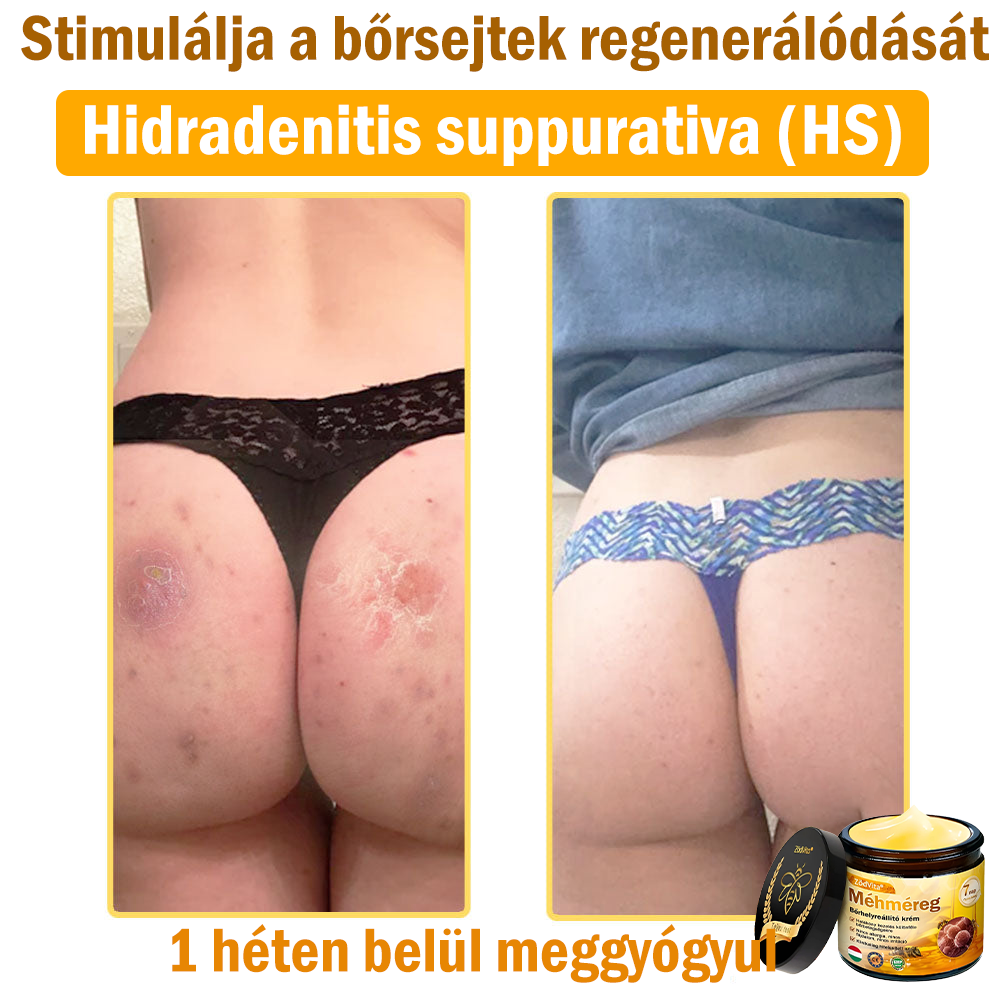 🌟 ZödVita® Méhméreg Bőrhelyreállító Krém 🧑‍⚕️Bőrgyógyász ajánlása ✅ CE jóváhagyott - 50ml
