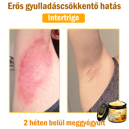 🌟 ZödVita® Méhméreg Bőrhelyreállító Krém 🧑‍⚕️Bőrgyógyász ajánlása ✅ CE jóváhagyott - 50ml