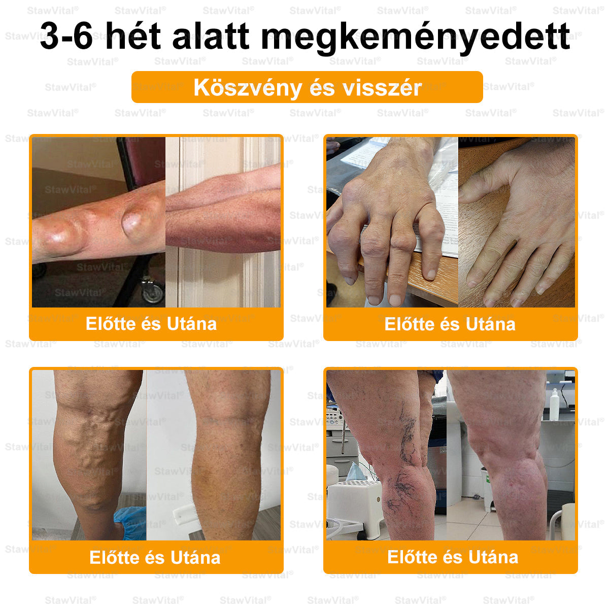 🟠𝑺𝒕𝒂𝒘𝑽𝒊𝒕𝒂𝒍® Botoxot és Méhmérget Tartalmazó Regeneráló Krém Ízületekre és Csontokra | MOT (Magyar Ortopéd Társaság) által tanúsított termék
