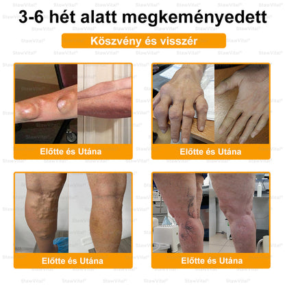 🟠𝑺𝒕𝒂𝒘𝑽𝒊𝒕𝒂𝒍® Botoxot és Méhmérget Tartalmazó Regeneráló Krém Ízületekre és Csontokra | MOT (Magyar Ortopéd Társaság) által tanúsított termék