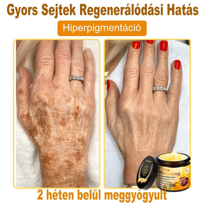 🌟 ZödVita® Méhméreg Bőr Helyreállító Krém 🔥Természetes Öregedésgátló, Feszesíti a Bőrt, Csökkenti a Ráncokat– 50ml