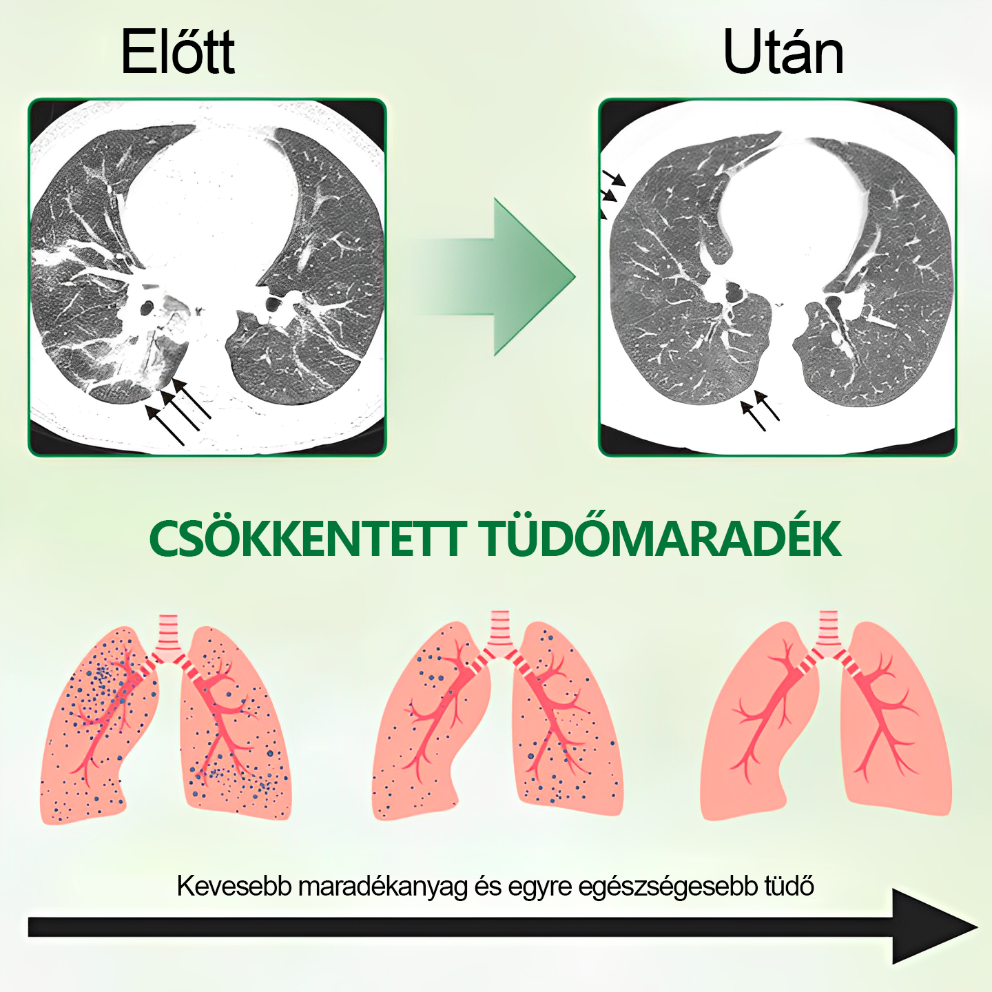 🍀𝐆𝐨𝐨𝐲𝐞𝐞𝐫™ 𝐅𝐞𝐣𝐥𝐞𝐭𝐭 𝐓ü𝐝ő𝐭𝐢𝐬𝐳𝐭í𝐭ó 𝐒𝐩𝐫𝐚𝐲-Támogatja a tüdő, a hörgők és az orrmelléküregek egészségét, elősegíti a légzőrendszer egészségét és a könnyebb légzést