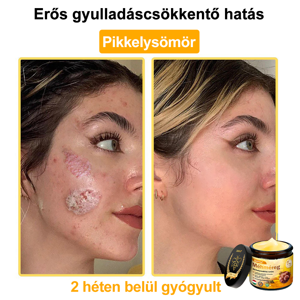 🌟 ZödVita® Méhméreg Bőrhelyreállító Krém 🧑‍⚕️Bőrgyógyász ajánlása ✅ CE jóváhagyott - 50ml