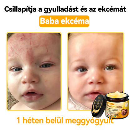 🌟 ZödVita® Méhméreg Bőrhelyreállító Krém 🧑‍⚕️Bőrgyógyász ajánlása ✅ CE jóváhagyott - 50ml