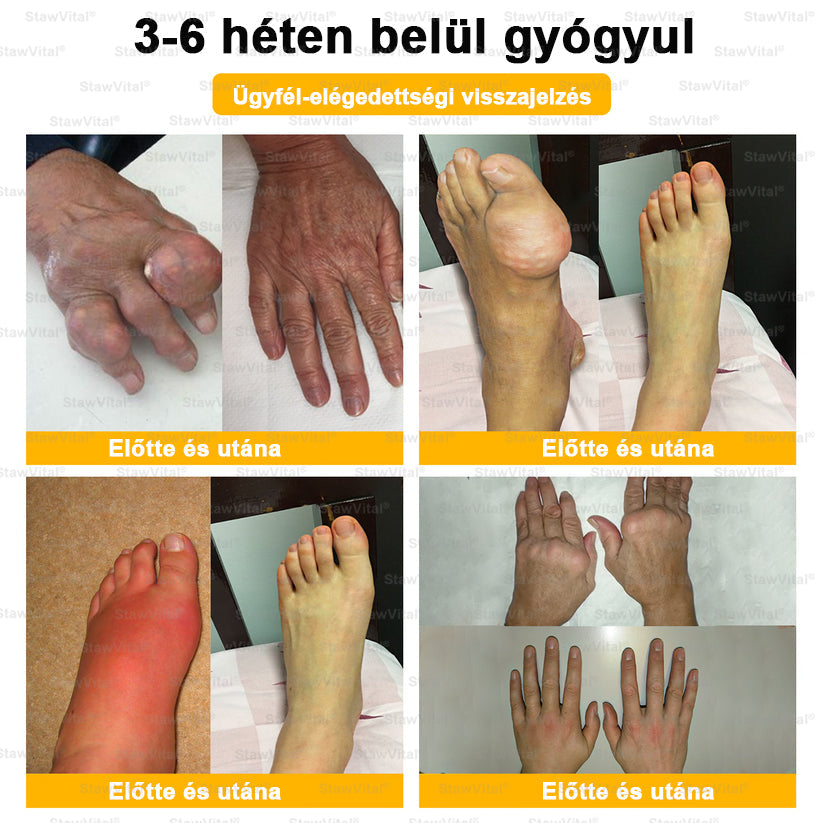🟠𝑺𝒕𝒂𝒘𝑽𝒊𝒕𝒂𝒍® Botoxot és Méhmérget Tartalmazó Regeneráló Krém Ízületekre és Csontokra | MOT (Magyar Ortopéd Társaság) által tanúsított termék