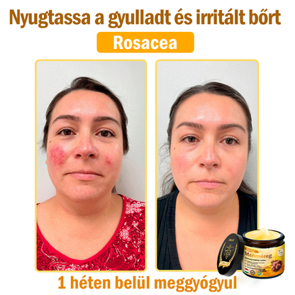 🌟 ZödVita® Méhméreg Bőrhelyreállító Krém 🧑‍⚕️Bőrgyógyász ajánlása ✅ CE jóváhagyott - 50ml