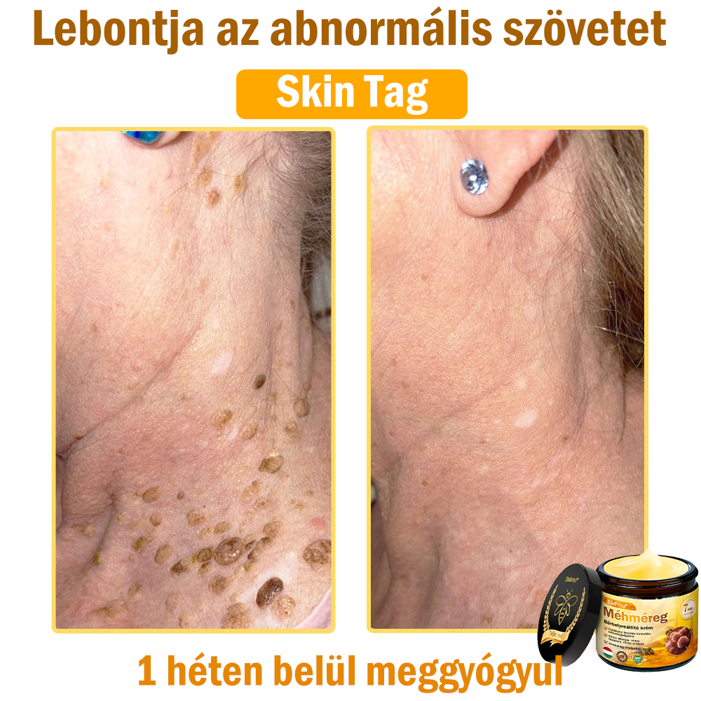 🌟 ZödVita® Méhméreg Bőrhelyreállító Krém 🧑‍⚕️Bőrgyógyász ajánlása ✅ CE jóváhagyott - 50ml