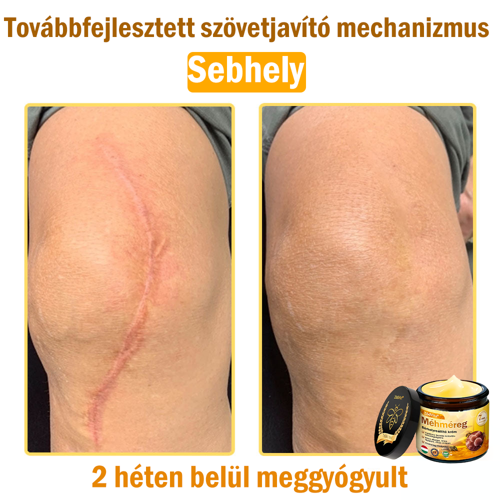 🌟 ZödVita® Méhméreg Bőrhelyreállító Krém 🧑‍⚕️Bőrgyógyász ajánlása ✅ CE jóváhagyott - 50ml