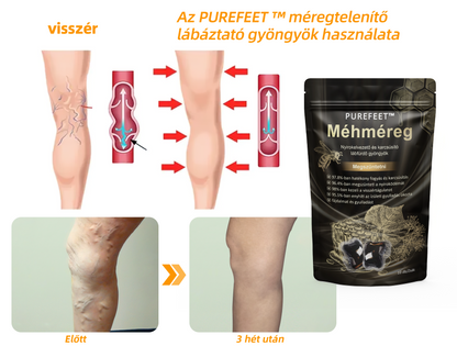 👑Purefeet™ Méhméreg Nyirokelvezető és karcsúsító lábfürdő gyöngyök - Minden nyirokproblémára és elhízásra alkalmas -CE tanúsítvánnyal