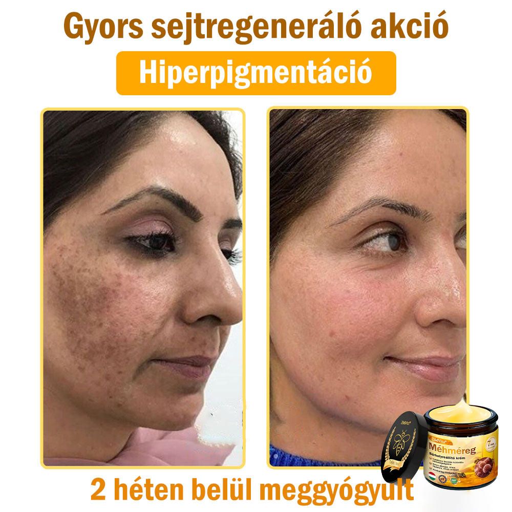 🌟 ZödVita® Méhméreg Bőrhelyreállító Krém 🧑‍⚕️Bőrgyógyász ajánlása ✅ CE jóváhagyott - 50ml