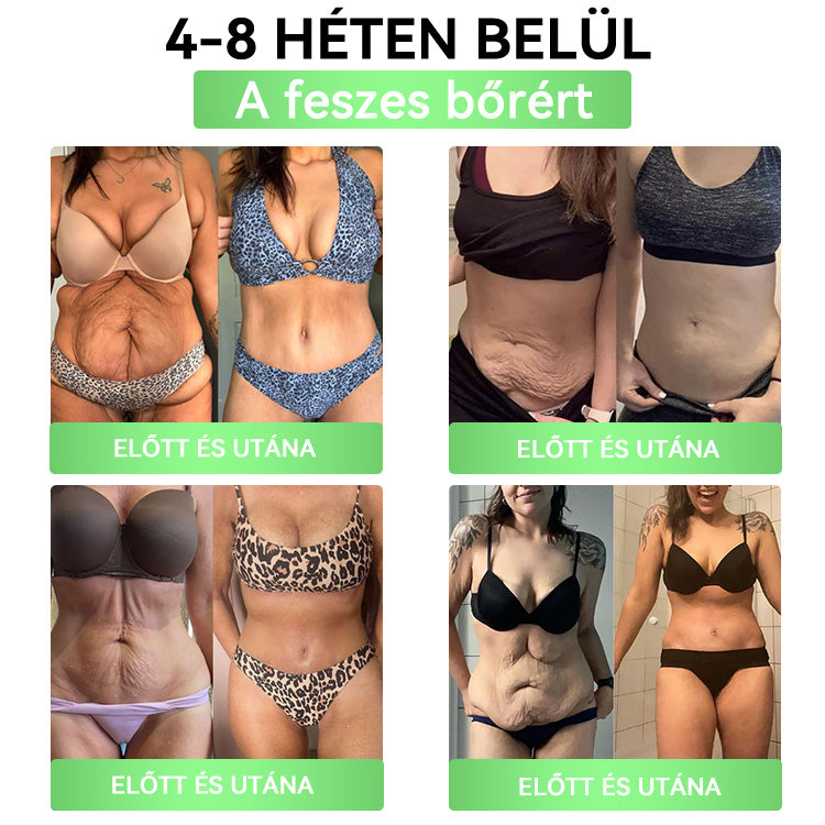 🍐DOOEKA® GLP-1 20-az-1 Slim & Health Orális Oldat – Egyszerű napi használat, látványos eredmény 7 nap alatt, 100 milliárd aktív probiotikummal ✅ testsúlykezelés, szív-, cukorbetegség-, bél- és női egészség, feszes bőr, energia.