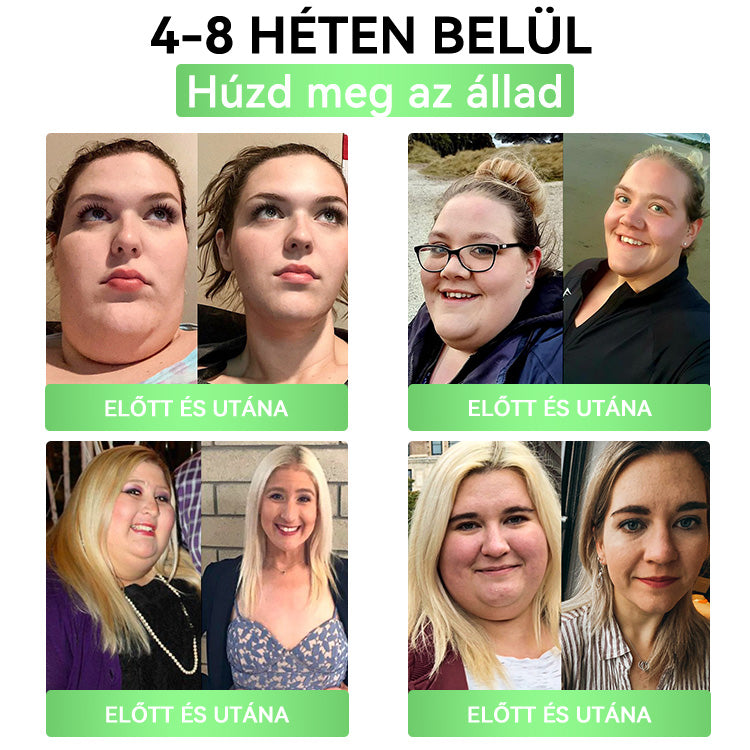 🍐DOOEKA® GLP-1 20-az-1 Slim & Health Orális Oldat – Egyszerű napi használat, látványos eredmény 7 nap alatt, 100 milliárd aktív probiotikummal ✅ testsúlykezelés, szív-, cukorbetegség-, bél- és női egészség, feszes bőr, energia.